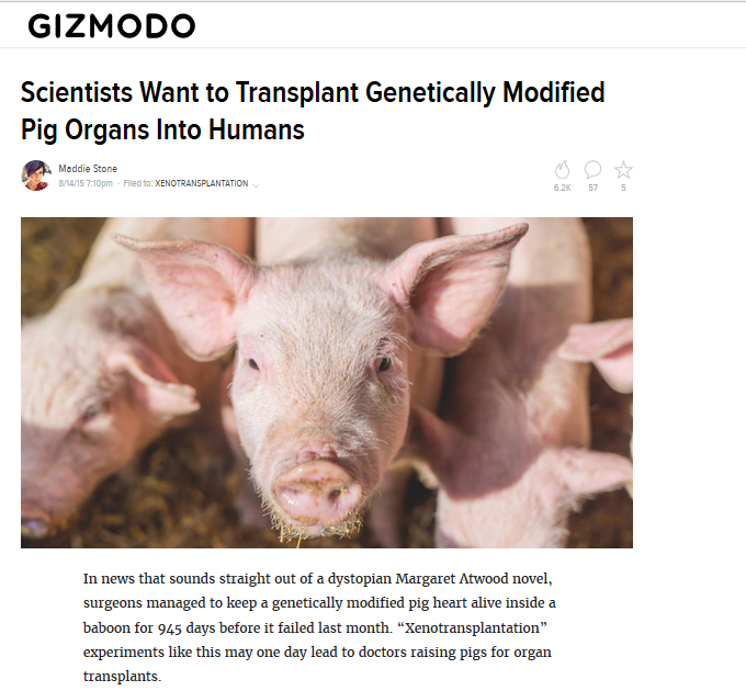 Image 4 - Gizmodo on Atwood and Pig Organs